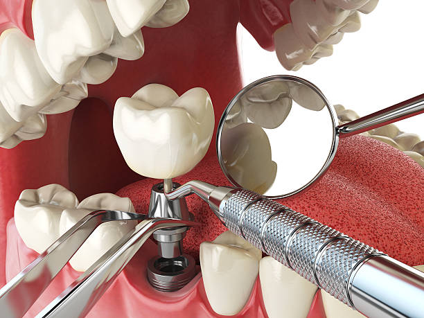 Best Emergency Dentist for Knocked-Out Tooth in Palatka, FL